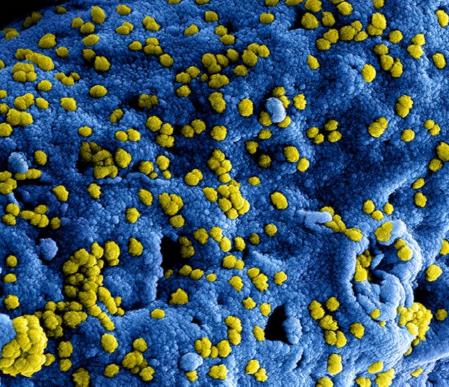 Фото: CDC: https://www.pexels.com/ru-ru/photo/3992937/