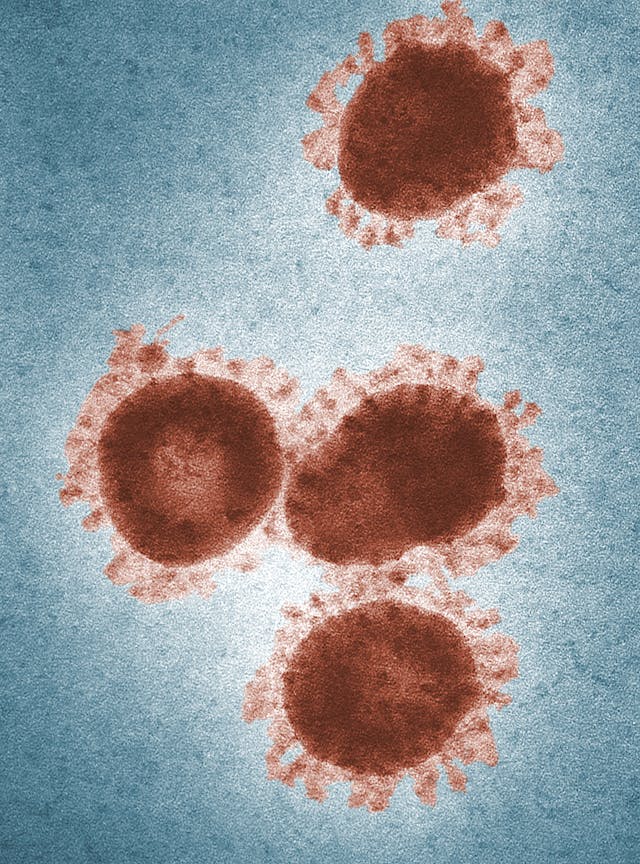 Фото: CDC: https://www.pexels.com/ru-ru/photo/3992945/